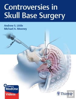 Bertrand.pt - Controversies In Skull Base Surgery