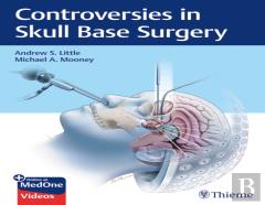 Controversies In Skull Base Surgery