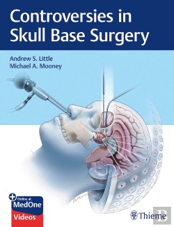 Bertrand.pt - Controversies In Skull Base Surgery