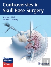 Controversies In Skull Base Surgery