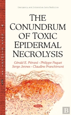 Bertrand.pt - Conundrum Of Toxic Epidermal Necrolysis