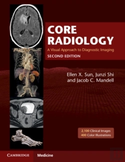 Bertrand.pt - Core Radiology