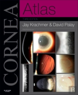 Bertrand.pt - Cornea Atlas