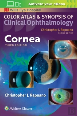 Bertrand.pt - Cornea