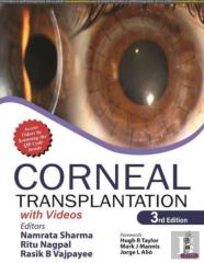 Corneal Transplantation