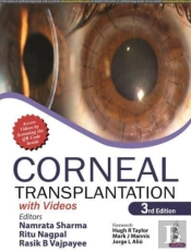 Corneal Transplantation