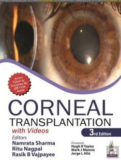 Bertrand.pt - Corneal Transplantation