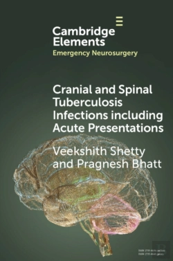 Bertrand.pt - Cranial And Spinal Tuberculosis Infections Including Acute Presentations