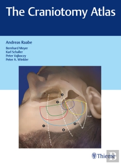 Bertrand.pt - Craniotomy Atlas