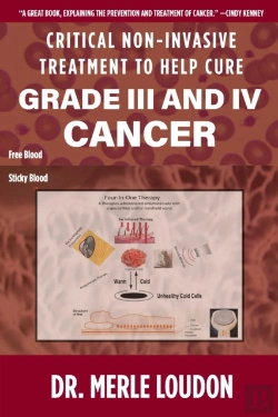 Bertrand.pt - Critical Non-Invasive Treatment To Cure Grade Iii And Iv Cancer