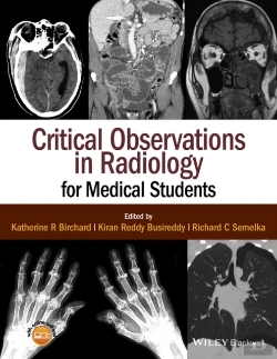 Bertrand.pt - Critical Observations In Radiology For Medical Students