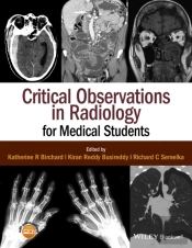 Critical Observations In Radiology For Medical Students