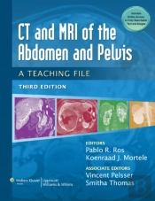 Ct And Mri Of The Abdomen Pelvis 3e
