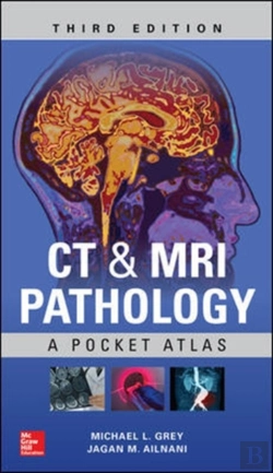 Bertrand.pt - Ct & Mri Pathology: A Pocket Atlas, Third Edition