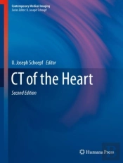 Ct Of The Heart