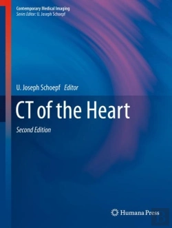 Bertrand.pt - Ct Of The Heart