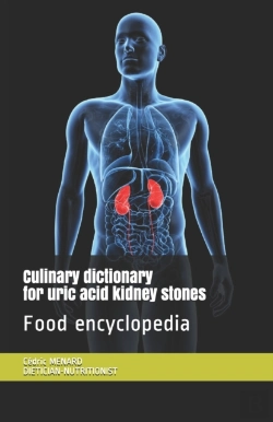 Bertrand.pt - Culinary Dictionary For Uric Acid Kidney Stones