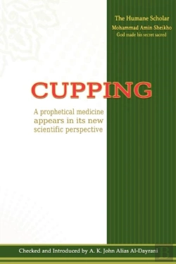 Bertrand.pt - Cupping