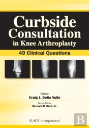 Curbside Consultation In Knee Arthroplasty