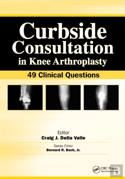 Bertrand.pt - Curbside Consultation In Knee Arthroplasty