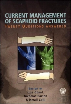 Bertrand.pt - Current Management Of Scaphoid Fractures