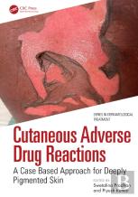 Cutaneous Adverse Drug Reactions