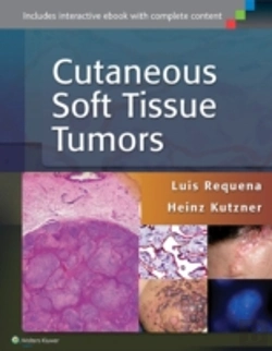 Bertrand.pt - Cutaneous Soft Tissue Tumors