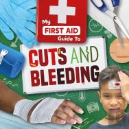 Cuts And Bleeding
