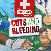 Cuts And Bleeding