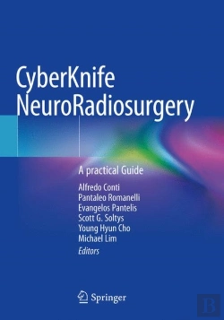 Bertrand.pt - Cyberknife Neuroradiosurgery