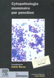Cythopathologie Des Lesions Du Sein