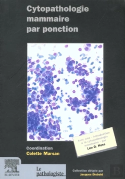 Bertrand.pt - Cythopathologie Des Lesions Du Sein