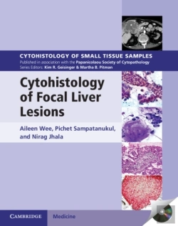 Bertrand.pt - Cytohistology Of Focal Liver Lesions