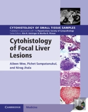 Cytohistology Of Focal Liver Lesions
