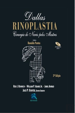 Bertrand.pt - Dallas – Rinoplastia