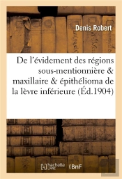 De L'Evidement Des Regions Sous-Mentionniere & Maxillaire Dans L'Epithelioma De La Levre Inferieure