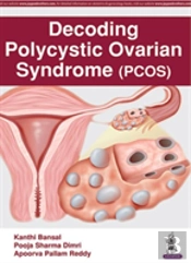Decoding Polycystic Ovarian Syndrome