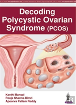 Bertrand.pt - Decoding Polycystic Ovarian Syndrome