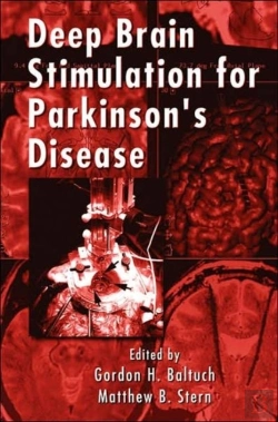 Bertrand.pt - Deep Brain Stimulation For Parkinson'S Disease