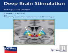 Deep Brain Stimulation