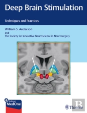 Deep Brain Stimulation