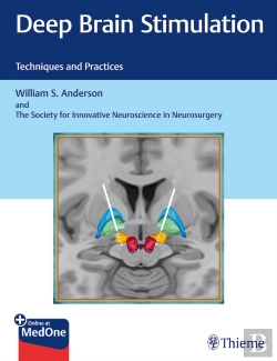 Bertrand.pt - Deep Brain Stimulation