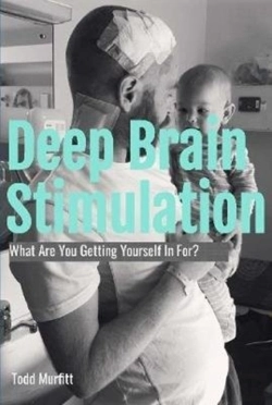 Bertrand.pt - Deep Brain Stimulation - What Are You Getting Yourself In For?