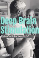 Deep Brain Stimulation - What Are You Getting Yourself In For?