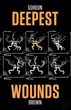Bertrand.pt - Deepest Wounds