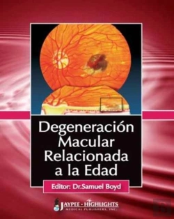 Bertrand.pt - Degeneracion Macular Relacionada A La Edad
