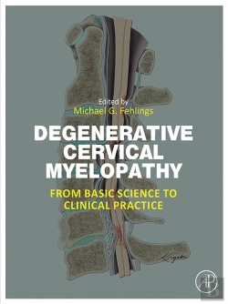 Bertrand.pt - Degenerative Cervical Myelopathy
