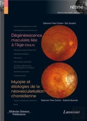 Dégénérescence Maculaire Liée À L'Âge (Dmla) ; Myopie Et Étiologies De La Néovascularisation Choroïdienne