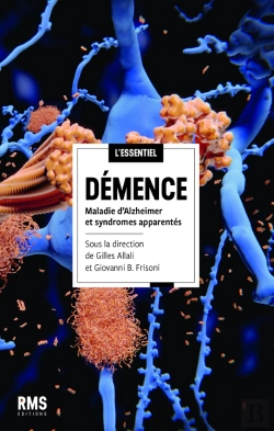 Bertrand.pt - Démence : Maladie D'Alzheimer Et Syndromes Apparentés