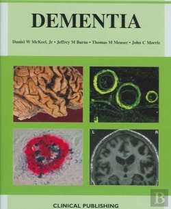 Bertrand.pt - Dementia